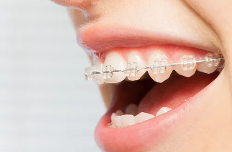 日本矯正歯科学会認定医が担当します