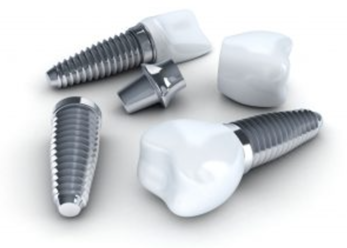 精密な診断と最新技術で、安全で確実なインプラント治療を実現します