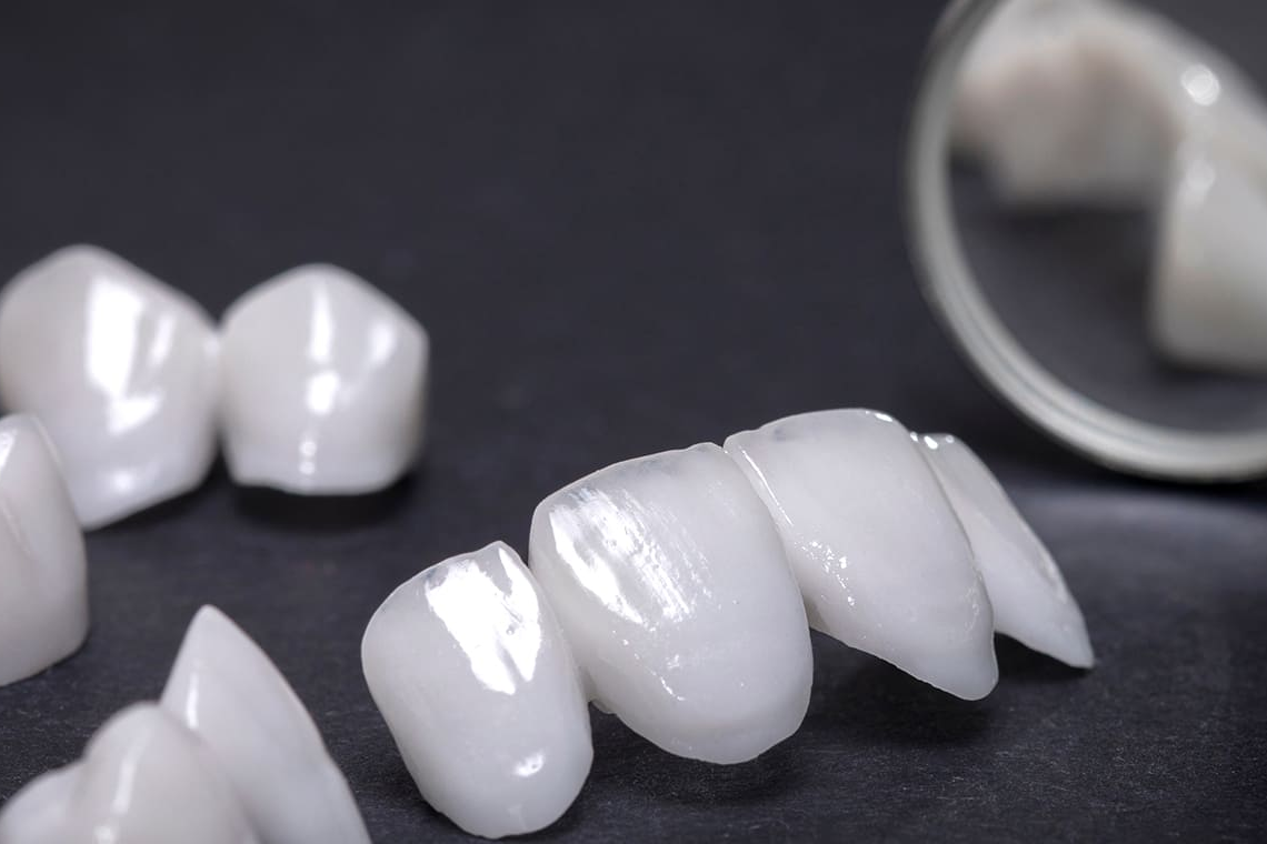 ご自身の歯と見た目が変わらない詰め物・被せ物ができます