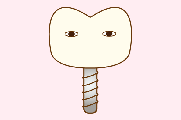 インプラント治療を行う際に、CT撮影を活用し、精密な手術計画を立てた上で治療を実施しています