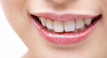 【我孫子前駅 徒歩5分】幅広い診療に対応し、患者様に寄り添うやすだ歯科クリニック