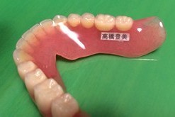 患者様一人ひとりの口腔内の状態に合わせて、最適な入れ歯を提案