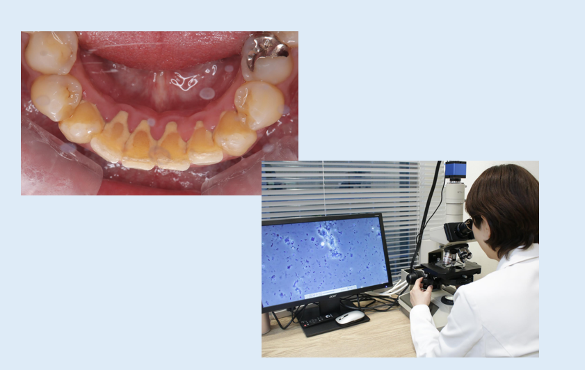 デンタルサロンナチュール銀座の歯周病治療プログラムは、患者様の歯を守り、再発を防ぐことに重点を置いています