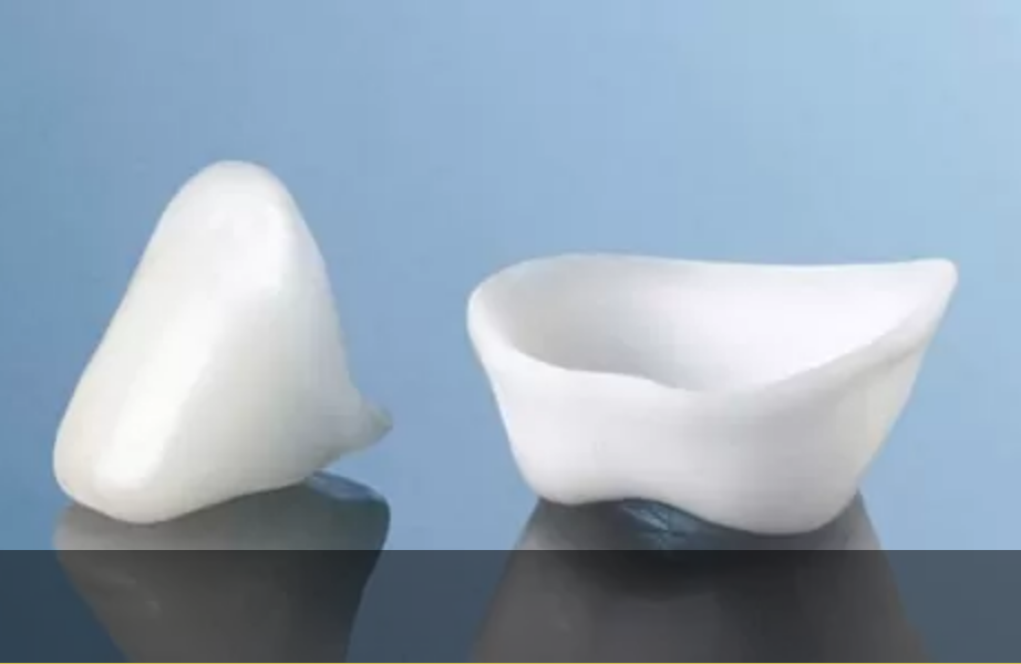 金属を使用しない「メタルフリー治療」を実践