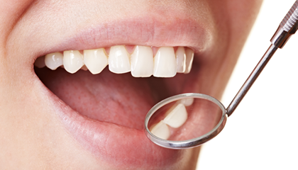 歯の見た目に重点をおいた治療です