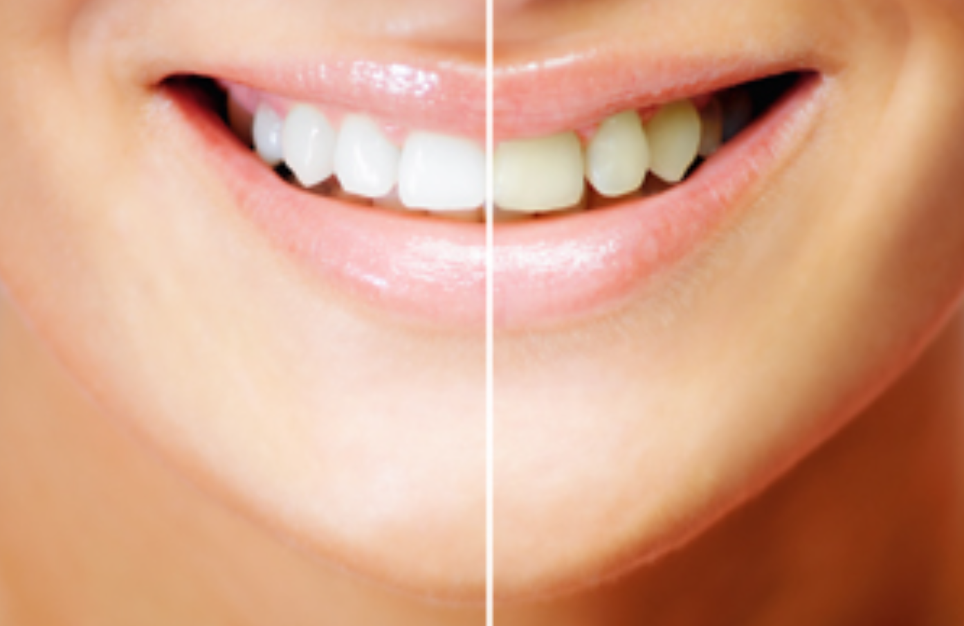 美しく自然な口元へ。