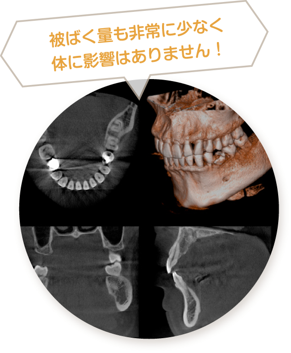 歯科用CTで精密な治療が可能です