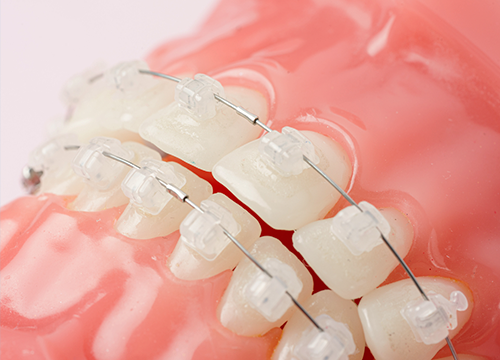 無料カウンセリングを実施しています