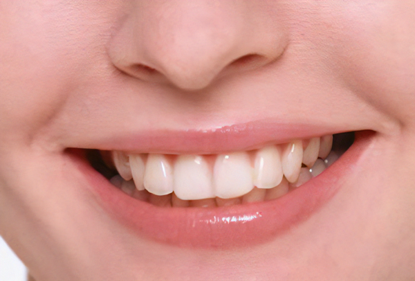 審美歯科治療を提供