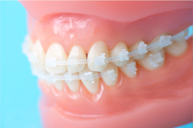 お子様の歯並びの悩みも対応可能