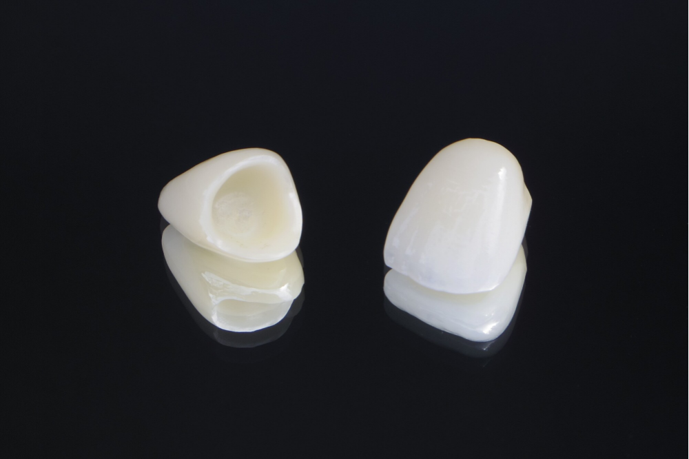 入れ歯が合わない、という方は一度ご相談ください