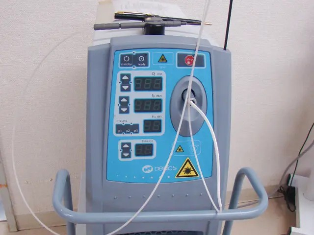 レーザー機器など最新機器完備