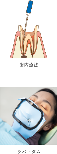 ラバーダムを採用