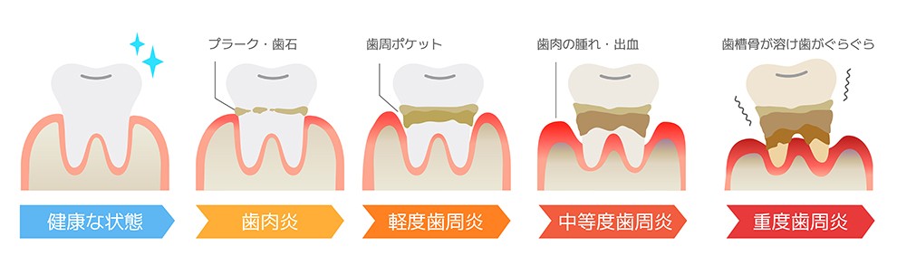原因菌を特定し内服薬で改善を図るアプローチを行っています