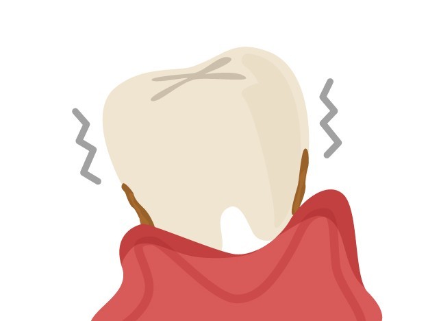 写真はイメージです