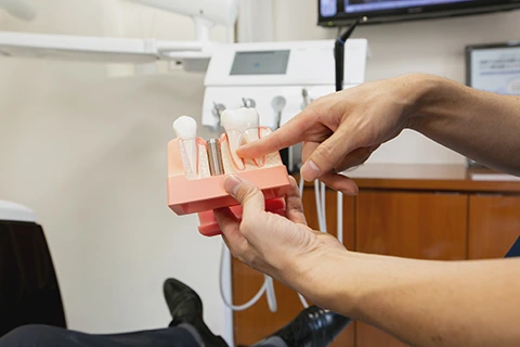 歯を失った患者様に対してインプラント治療を行っています