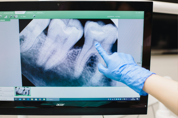 ※画像はイメージです