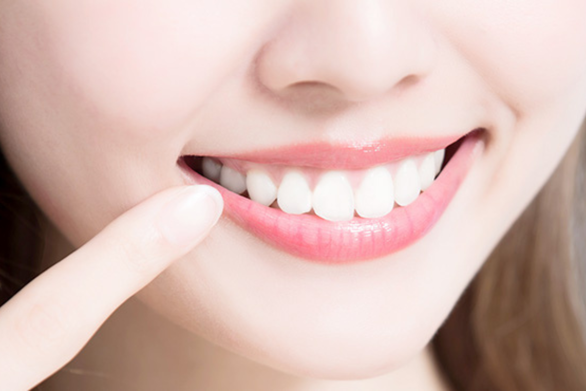 ホワイトニング治療-笑顔の自信は口元から始まります