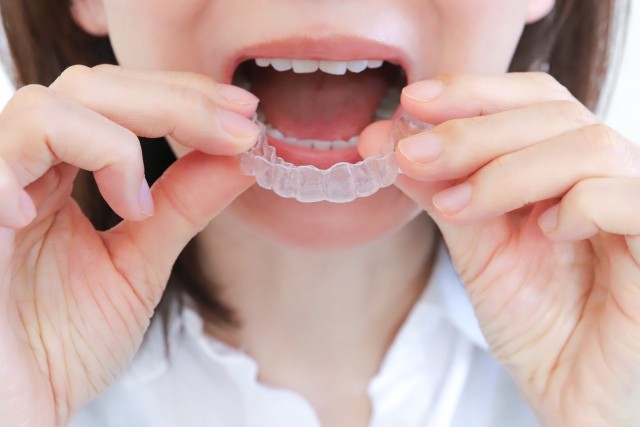 気軽に始められるマウスピース矯正