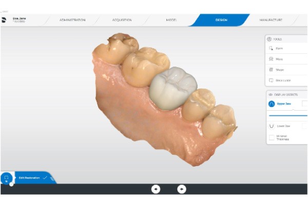 理想に近い補綴物を作ることが可能