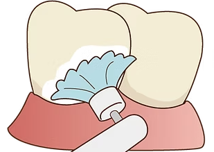 毎日のケアに加えて、専門的なクリーニングで口腔環境を整える