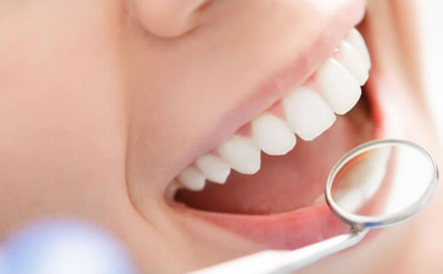 予防治療で長期的な口腔健康をサポートします