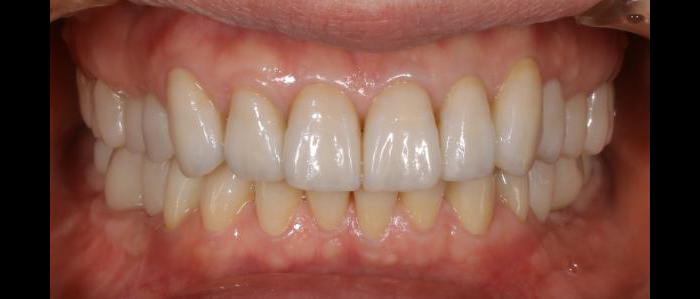 健康的な口腔環境を長く維持できる治療を提供します