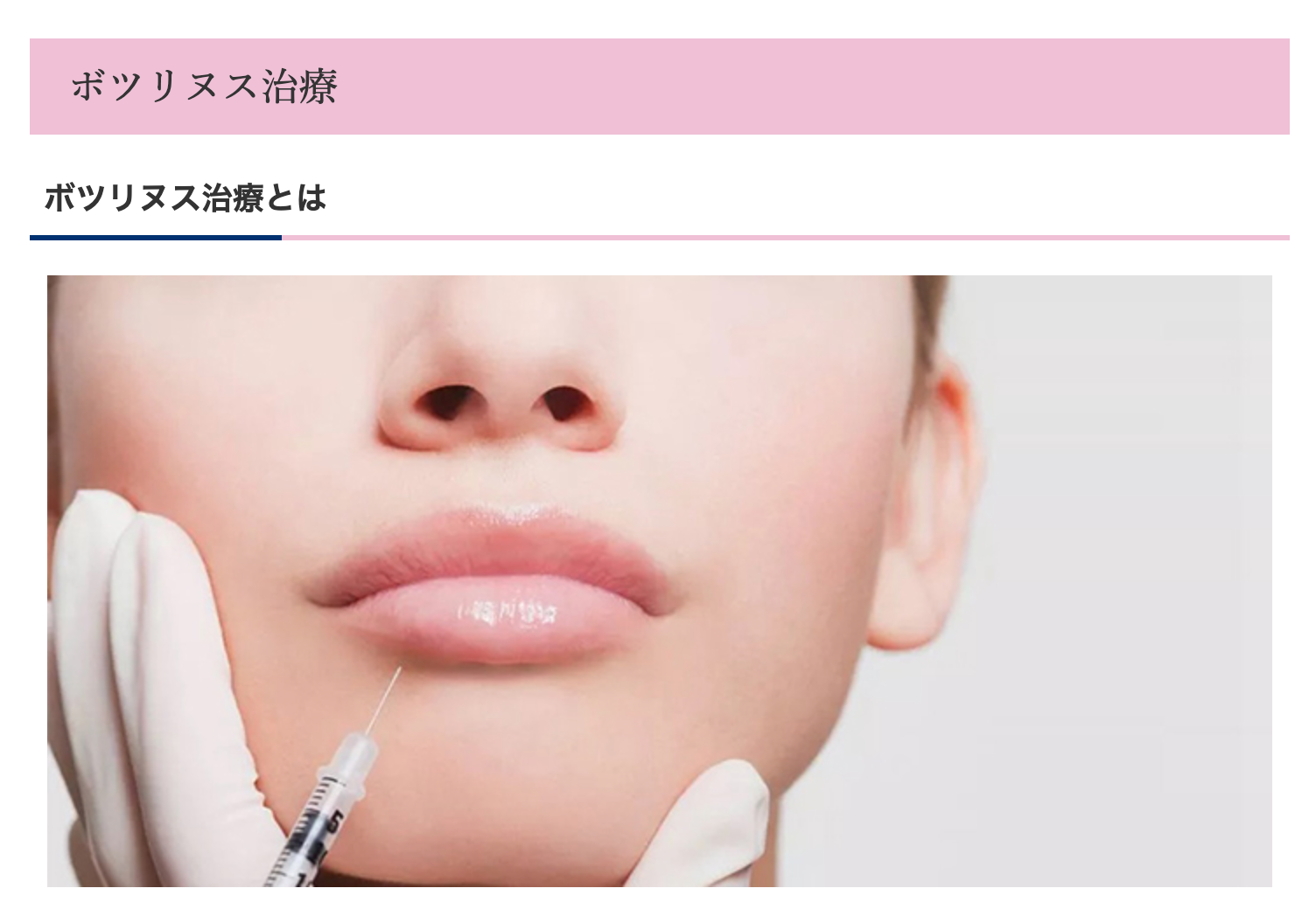 歯ぎしりや食いしばりなどにお悩みの患者様に向けてボツリヌス治療を提供しています