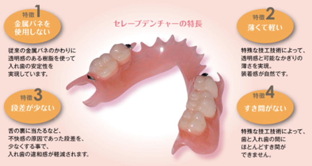 セレーブデンチャーの特徴