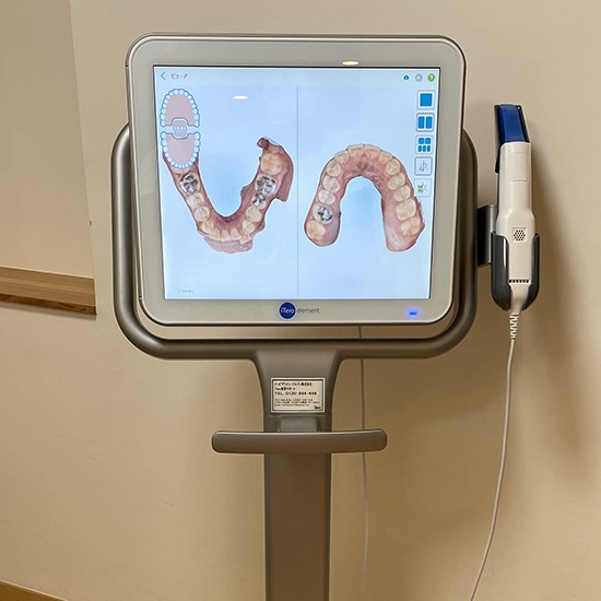 口腔内スキャナーで正確に口腔内を把握