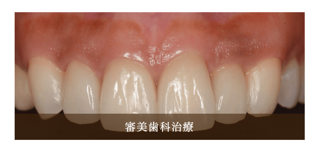 審美歯科治療を通じて患者様の口元に自然な美しさを提供しています