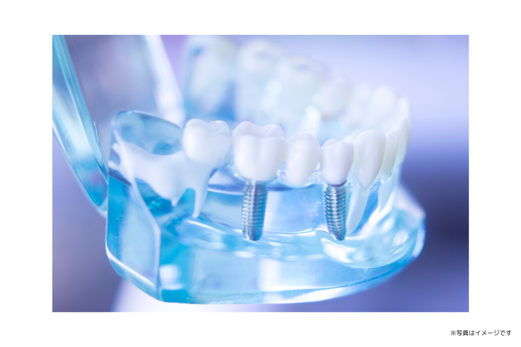 院長は日本口腔インプラント学会専修医の資格を持ち、豊富な知識と技術で患者様の治療にあたります。