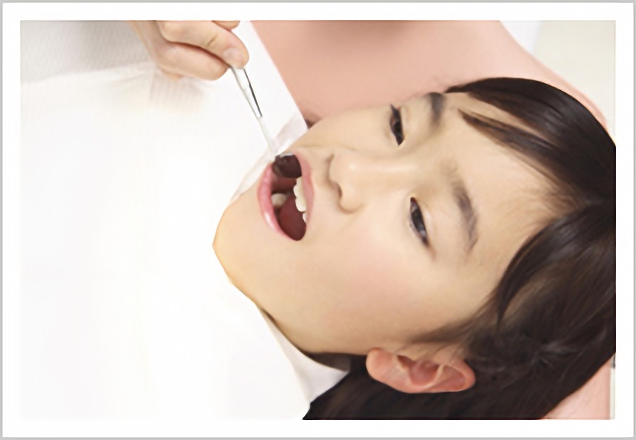 お子様の歯の健康をサポート