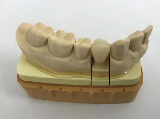 CAD/CAMシステムを活用した歯冠修復・欠損補綴治療を提供