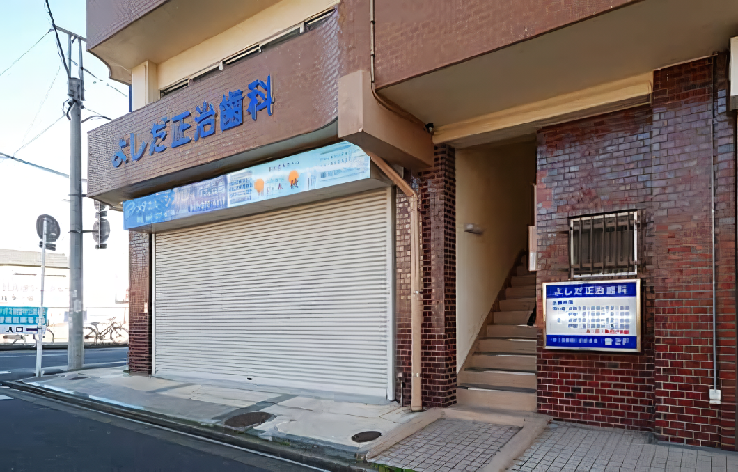 保険適応の銀歯の場合、見た目が悪いことや金属アレルギーを発症するリスクがあります