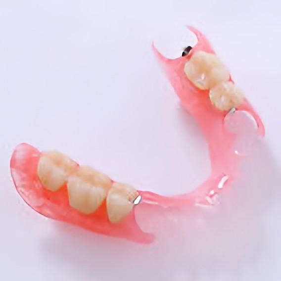 ノンクラスプデンチャー