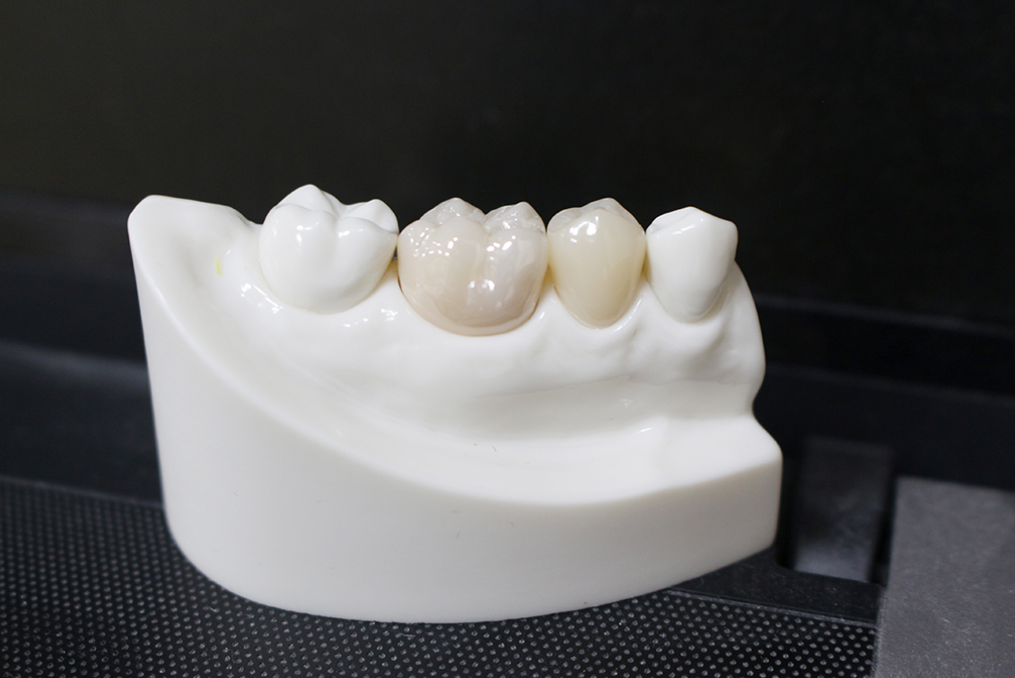 安全で確実なホワイトニングで、自然な白さと美しい笑顔を実現します