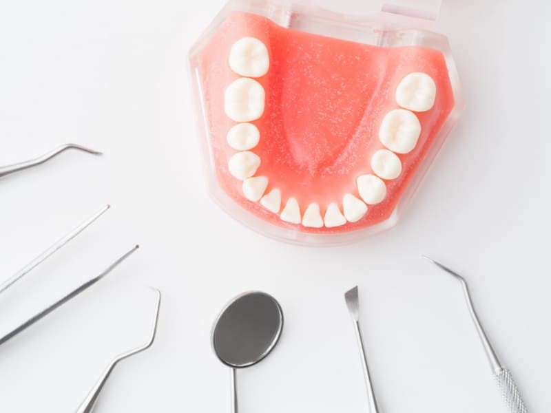 定期的な検診で口腔内の異常を早期に発見します