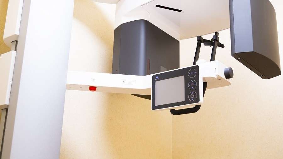 精緻にインプラント治療を行うための最新のCT