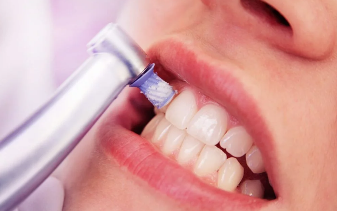 定期検診とプロフェッショナルケアで実現する予防歯科