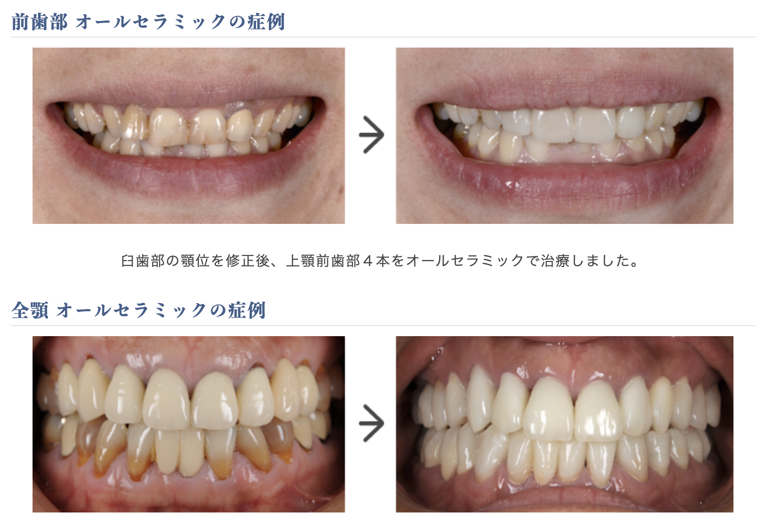 最新の歯科技術を活用した審美歯科治療を提供しています