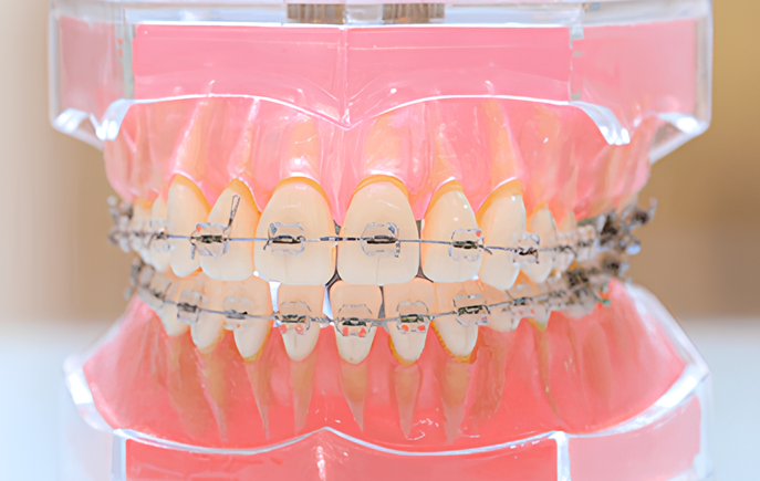 小児から成人まで専門的な矯正治療で理想的な歯並びと口腔機能を実現