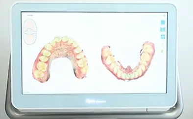 患者様と密にコミュニケーションを取りながら入れ歯作製