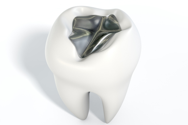 ※画像はイメージです