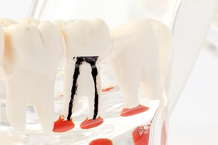 マイクロスコープを使った精密で正確な治療を行っております。