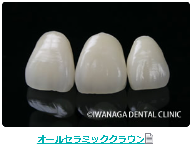 オールセラミッククラウンによる治療例