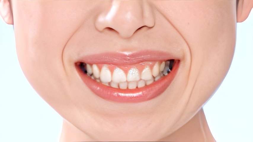 定期管理で健康な口元を守りましょう