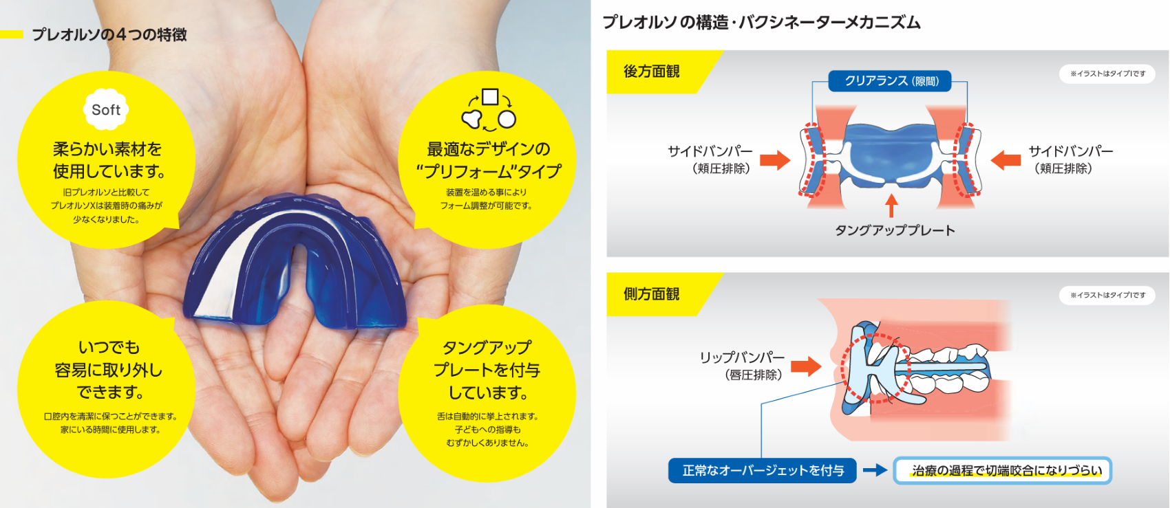 プレオルソによる矯正は取り外し式のため、痛みや違和感が少なく、日常生活にも支障をきたしにくい点が特徴です