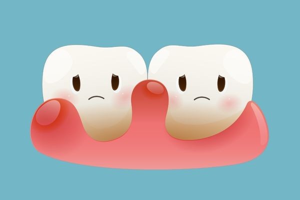 ※画像はイメージです