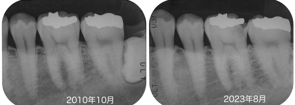 患者様の歯の健康を長期間にわたってサポートしていきます